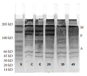 Figura 4. Patrón electroforético SDS-PAG E de las proteínas del pulpo fresco sometido a diversos tratamientos. S=patrón de peso molecular, C= muestra control; E= pulpo escaldado; 25=pulpo cocido por 25 min; 35=pulpo cocido por 35 min; 45=pulpo cocido por 45 min. M=miosina, P=paramiosina, A=actina.