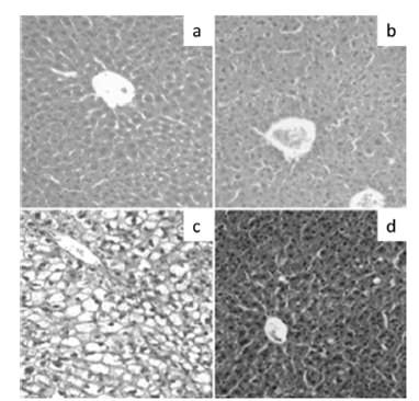 FIGURE 1. Effect of fish oil supplementation on liver histology in mice subjected to high fat diet (HFD). Representative liver sections from animals given (a) control diet, (b) control diet plus fish oil, (c) HFD, and (d) HFD plus fish oil (hematoxylin-eosin liver sections from a total of 9 animals per experimental group; original magnification x 40).