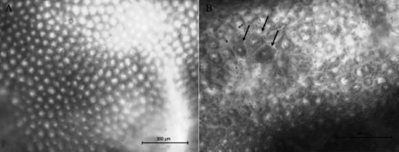 FIGURA 2. Imagen representativa de la superficie de la mucosa del colon distal de ratones inyectados con NaCl (control, A) o con azoximetano (AOM, B) después de la tinción con azul de metileno. Las flechas indican la localización de FCA.