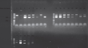 FIGURA 1. Productos amplificados de los genes nheA, nheB y nheC de B. cereus en gel de agarosa al 2% con bromuro de etidio (0,0005 mg/mL).