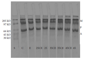 Figura 5. Patrón electroforético SDS-PAGE de las proteínas del pulpo congelado a -20 º C por 2 meses y sometido a diversos tratamientos. S=patrón de peso molecular: miosina 205 kD, fosforilasa B 97 kD, BSA 66 kD, ovoalbúmina 45 kD, anhidrasa carbónica 29 kD. C= muestra congelada, E= pulpo escaldado; 25CE=pulpo escaldado y cocido por 25 min; 25 =pulpo cocido por 25 min; 35CE=pulpo escaldado y cocido por 35 min; 35 =pulpo cocido por 35 min; 45CE=pulpo escaldado y cocido por 45 min; 45 =pulpo cocido por 45 min. M=miosina, P=paramiosina, A=actina.