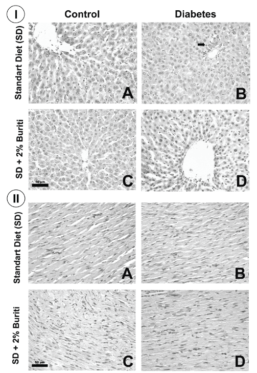 Figure 2: Representative hematoxylin and eosin-stained histological sections of rat liver (I) and of rat heart (II) belonging to the controls groups (A e C) and diabetics groups (B e D) as received diet (standard or with 2% BPF). Arrow: corresponds to a discrete inflammation.