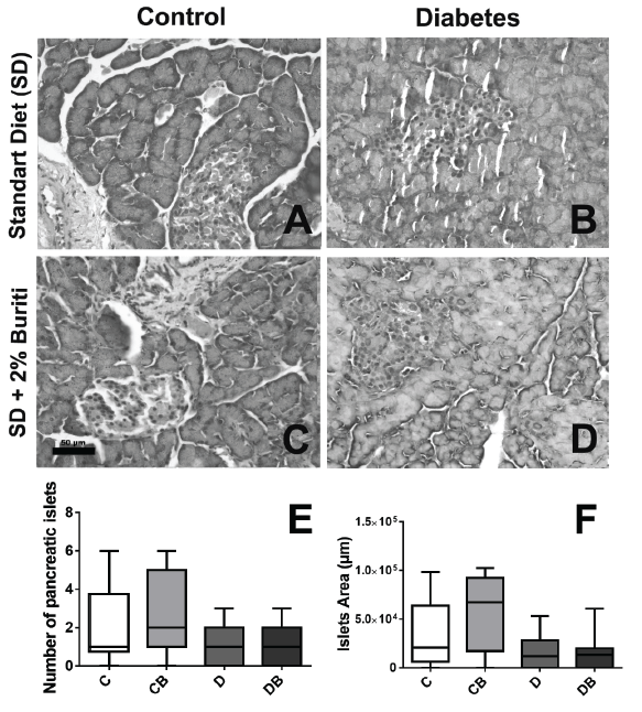 Figure 3: Representative hematoxylin and eosin-stained histological sections of rat pancreas belonging to the controls groups (A e C) and diabetics groups (B e D) as received diet (standard or with 2% BPF). Number of pancreatic islets (E) and islet area (F) in control and diabetic rats. Data are presented as median and percentiles 25 and 75 (Mann-Whitney). C: Control; CB: Control + BPF; D: Diabetic; DB: Diabetic + BPF.