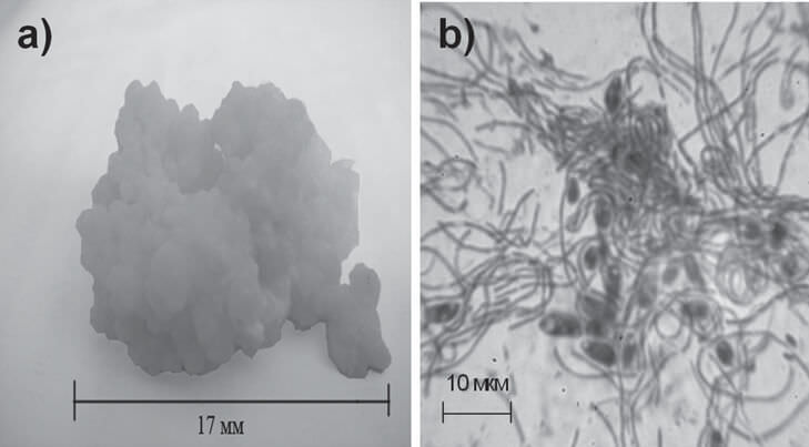 FIGURE 1. The photo of the lump natural association “Tibetan Kefir Grains” (magnification in 5.9 times) (a) and the microscopic picture of the natural association “Tibetan Kefir Grains” (Light microscope, magnification in 1500 times) (b).
