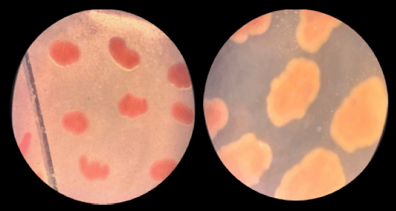 Figura 2. Características morfológicas de la Salmonella spp.
