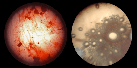Figura 3. Descripción de Tinción Gram y Catalasa de la Salmonella spp