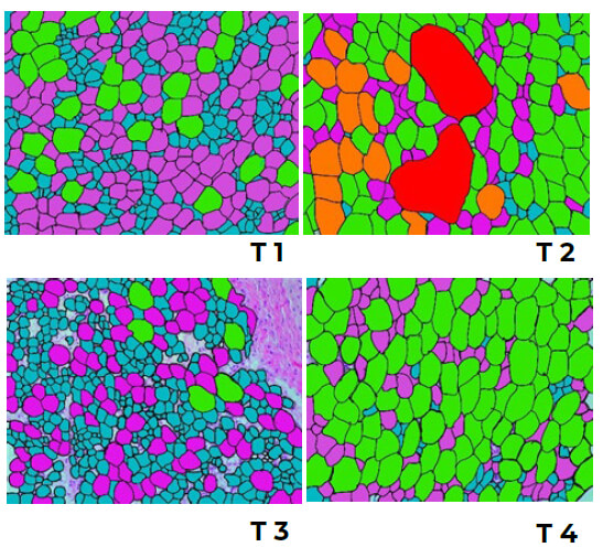 Figura 1: Análisis microscópico del tejido adiposo subcutáneo de pollitos Cobb 500 alimentados con dietas conteniendo diferentes fuentes de ácidos grasos. T1: 97% Dieta basal (DB) + 3% material inerte; T2: 97% DB + 3% manteca vegetal parcialmente hidrogenada; T3: 97% DB + 3% aceite de quinua; T4: 97% DB + 3% aceite de pescado. Objetivo 20X (Leica DM750).