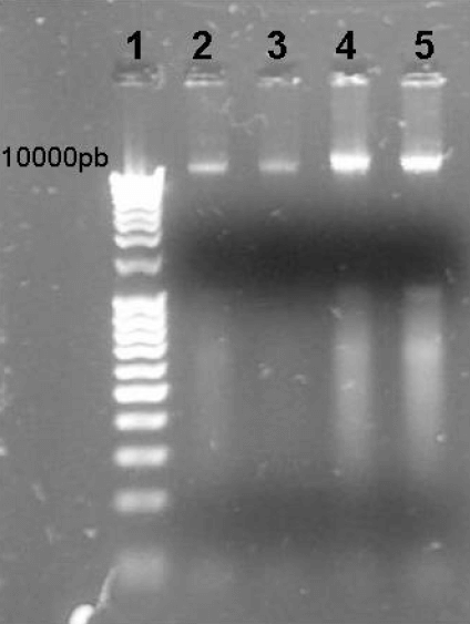 FIGURA 1 Gel de agarosa con los productos obtenidos después de una extracción de ADN en cepas de Staphylococcus aureus. 1) Marcador molecular Mass Ruler DNA®. 2,3) ADN ATCC 13565. 4,5) ADN ATCC 58.