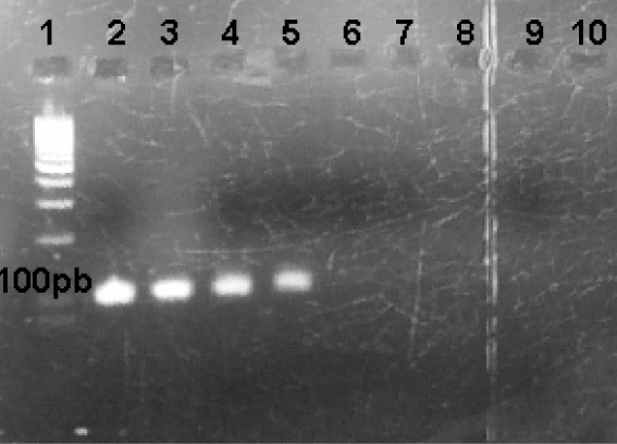 FIGURA 2 Gel de agarosa con los productos obtenidos a partir del PCR en las cepas control. 1) Marcador Molecular Mass Ruler DNA®. 2) Control positivo (1:1). 3) Control positivo (1:10). 4) Control positivo (1:50). 5) Control positivo (1:100). 6) Control negativo (1:1). 7) negativo (1:10). 8) Control negativo (1:50). 9) Control negativo (1:100). 10) Blanco
