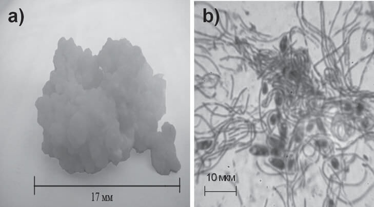FIGURE 1. The photo of the lump natural association “Tibetan Kefir Grains” (magnification in 5.9 times) (a) and the microscopic picture of the natural association “Tibetan Kefir Grains” (Light microscope, magnification in 1500 times) (b). 